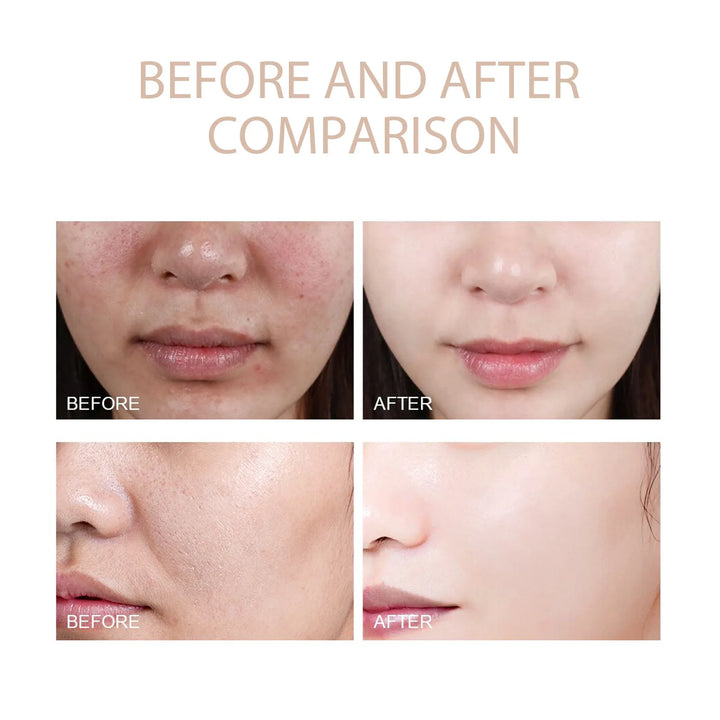 Deep Cleansing Exfoliating Gel – Facial Scrub & Moisturizer 50g