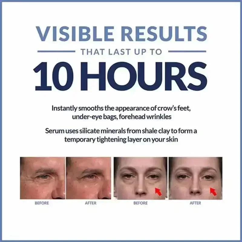 Instant Anti-Aging Eye Cream