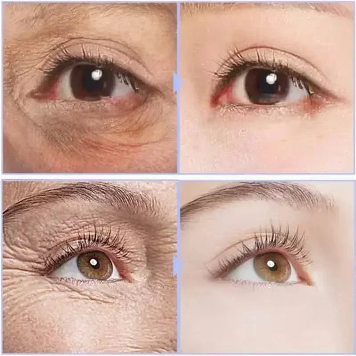 Instant Anti-Aging Eye Cream